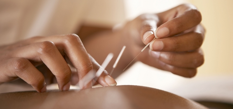 Initial Assessment & Acupuncture Treatment